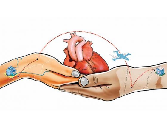 Heart transplant surgery in Kolkata for the first time