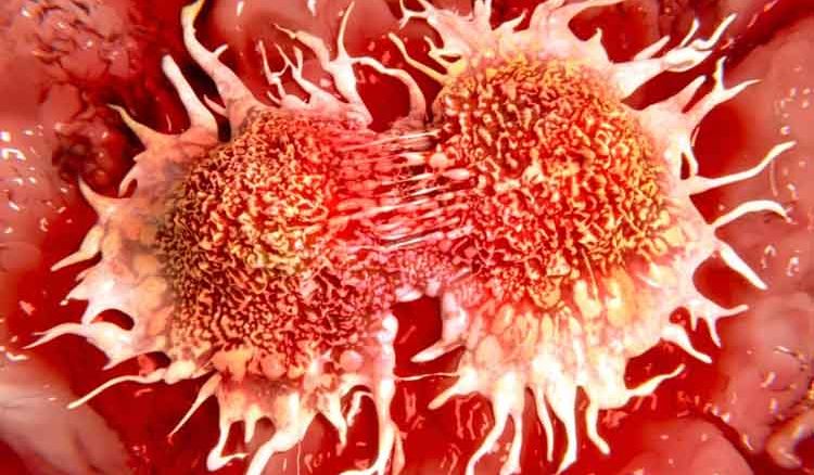 Team work is necessary to defeat Cancer