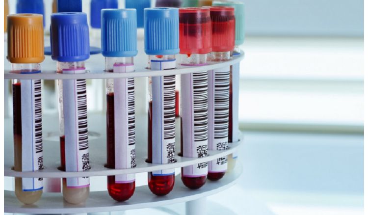 An ultra-low-cost blood test device has been invented by Kharagpur IIT Scientists