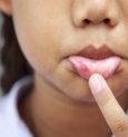 ঠোঁটের রং বদলে গেলে সচেতন হোন