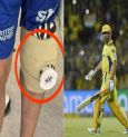 Why is Dhoni going to be admitted to the hospital in Mumbai ?
