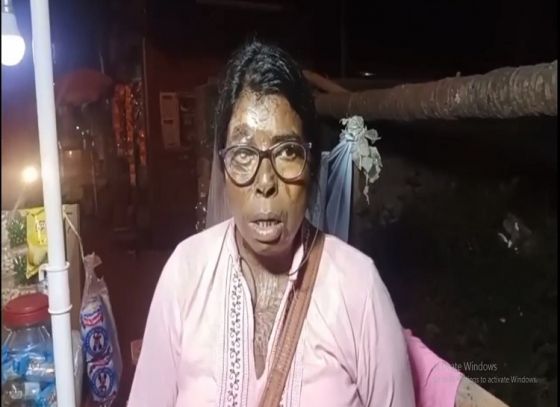 অ্যাসিড আক্রান্ত হয়েও ভেঙে পড়েননি তিনি! ঠেলাগাড়িতে রুটি বেচেই জীবনের সাথে লড়াই চালিয়ে যাচ্ছেন বারুইপুরের মমতা