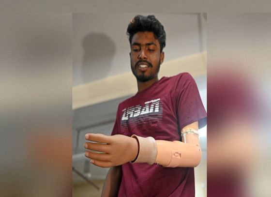 After Nearly 11 Months Of Losing Left Hand, Riaz Gets An Artificial Left Hand In SSKM