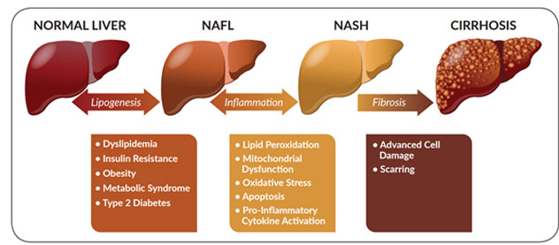 liver-content